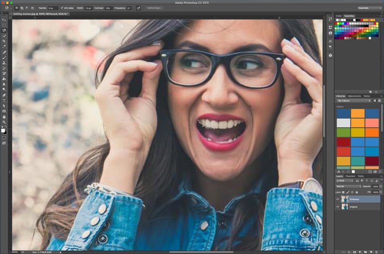 Teeth_whitening_-_lasso_1.jpg