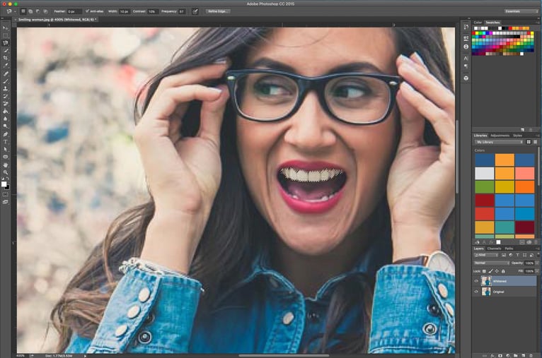 Teeth_whitening_-_selection.jpg