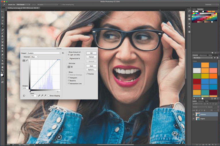 Teeth_whitening_-_whitened.png