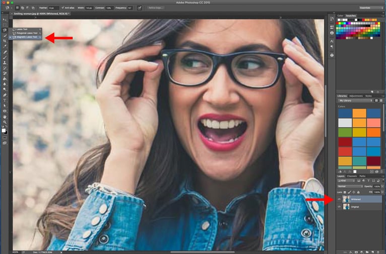 Teeth_whitening_-_zoom_in.jpg
