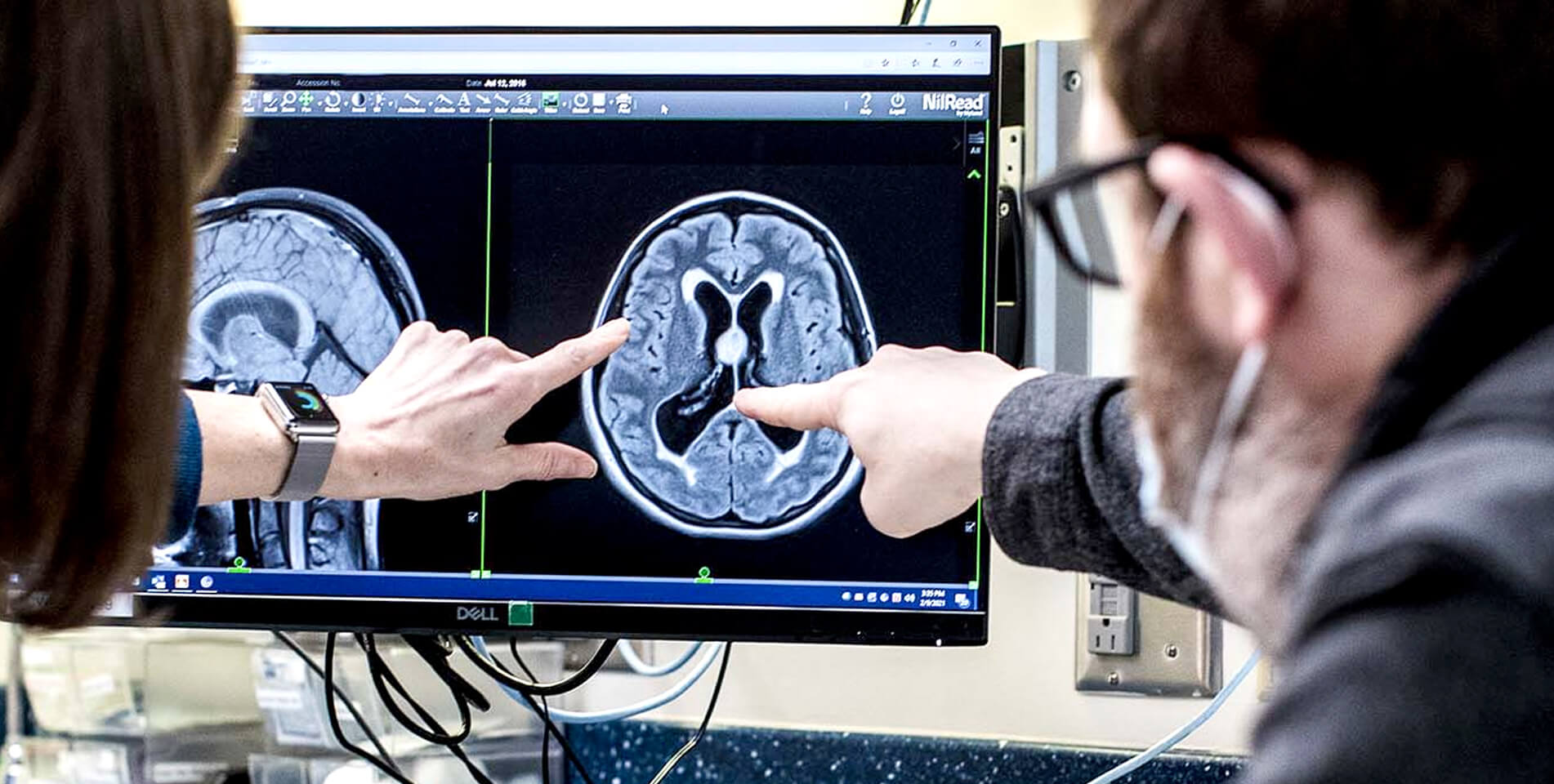 Doctors looking at brain scan.